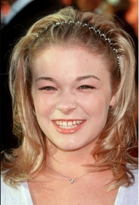 leann rimes teeth in 1985