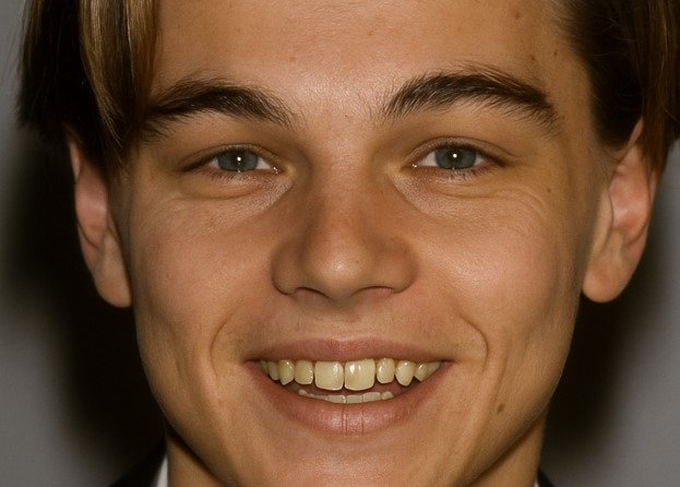 leonardo dicaprio teeth in 1990