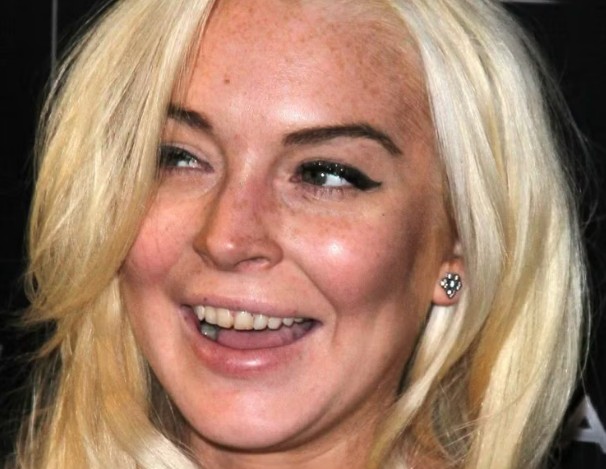lindsay lohan teeth in 2011