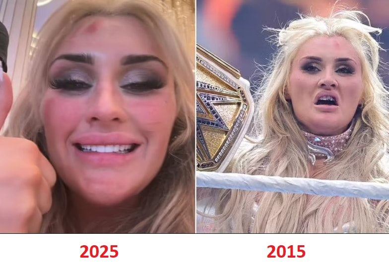 new tiffany stratton teeth before after injury