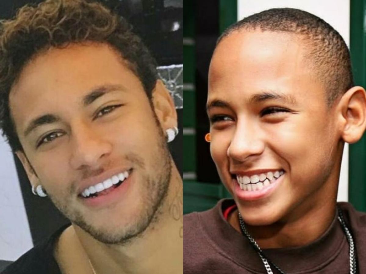 neymar teeth before after