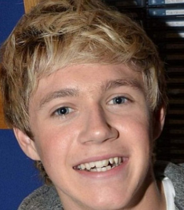 dientes de Niall Horan en 2007