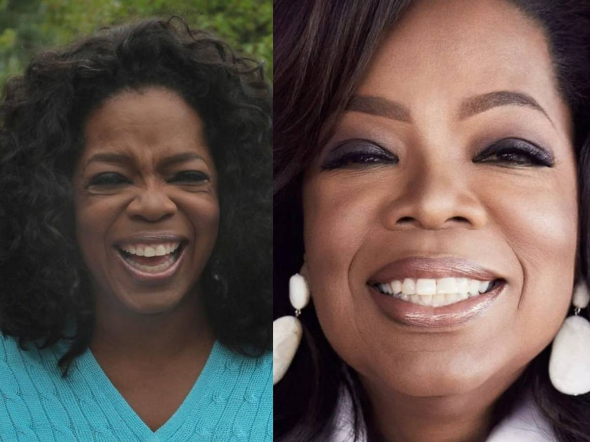 oprah winfrey teeth before after