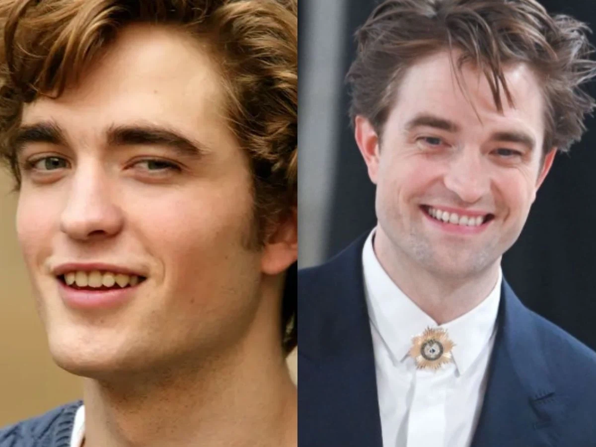 robert pattinson teeth before after
