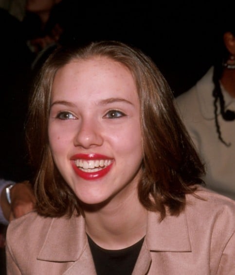 dents de scarlett johansson en 2000