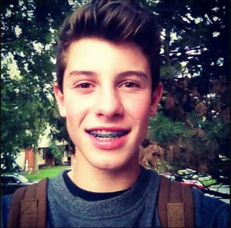 shawn mendes tænder i 2011