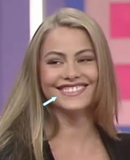 les dents de Sofia Vergara en 1993