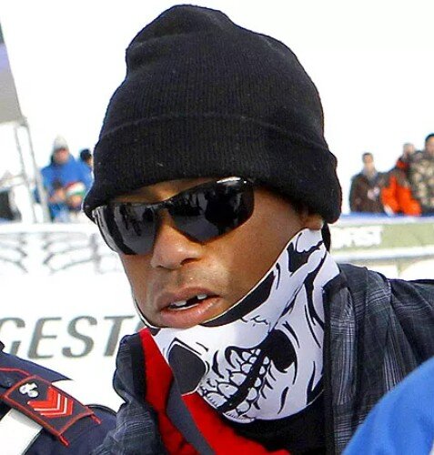 tiger woods teeth