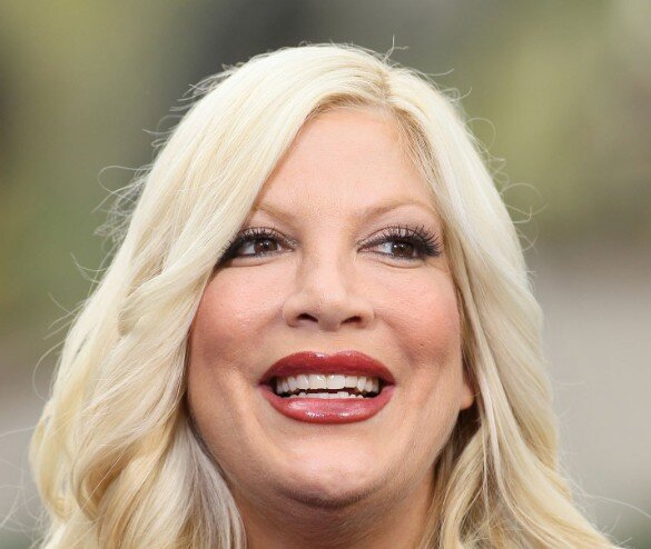 2010'da tori spelling dişler