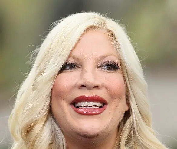 tori spelling teeth in 2010