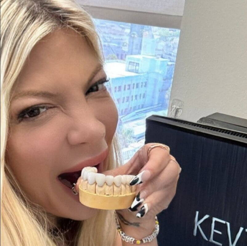 2024'te tori spelling dişler
