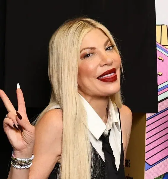 tori spelling teeth in 2025