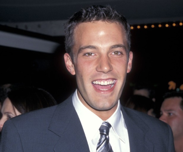 ben affleck teeth in 1997