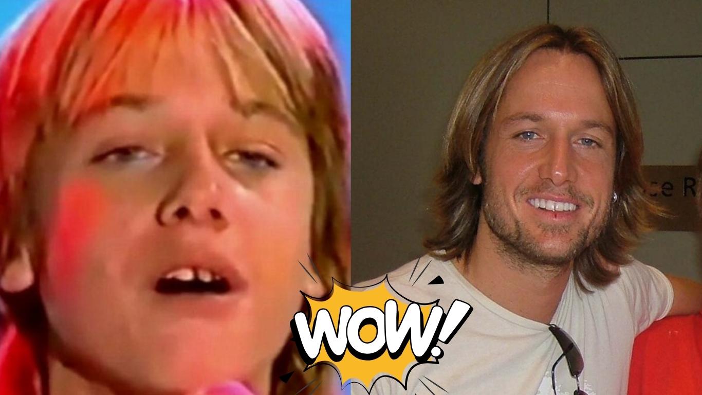 keith urban teeth before after