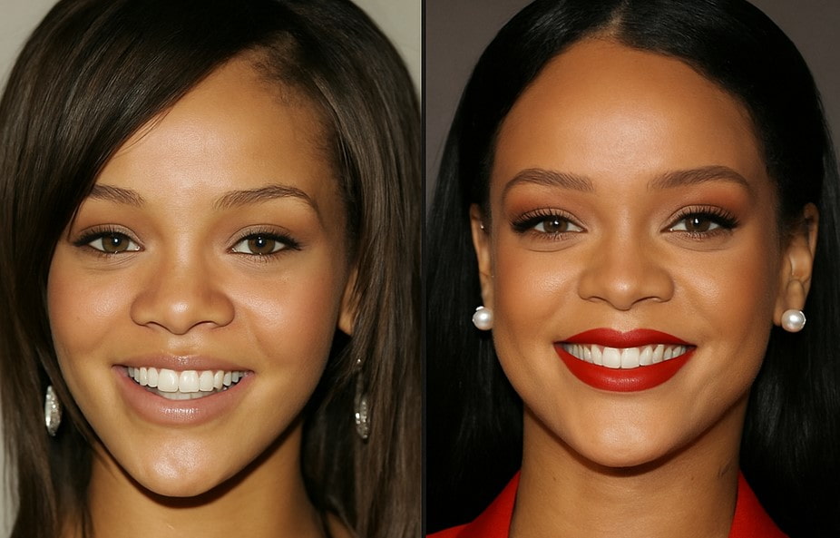 rihanna teeth before and after