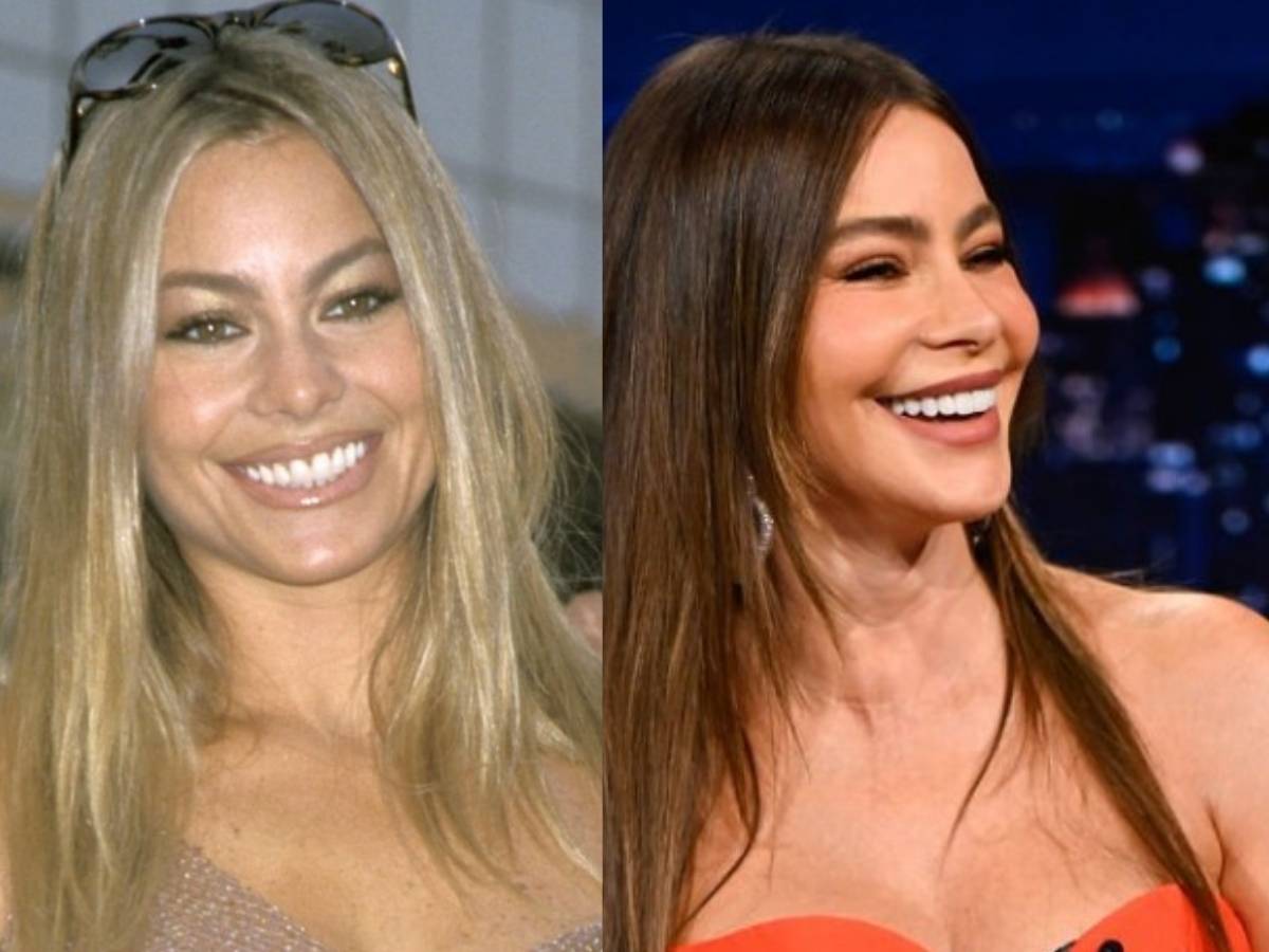 Sofia Vergara’s New Teeth After Veneers