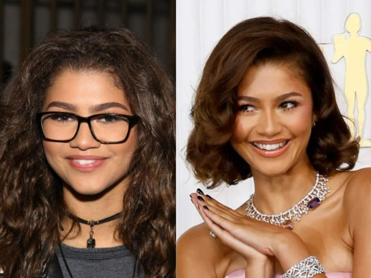 zendaya teeth before after