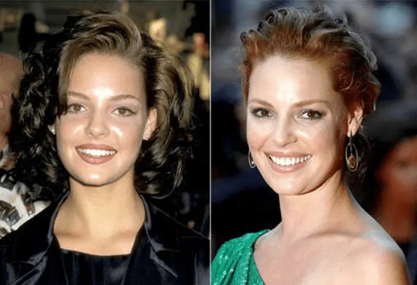 Transformarea danturii lui Katherine Heigl