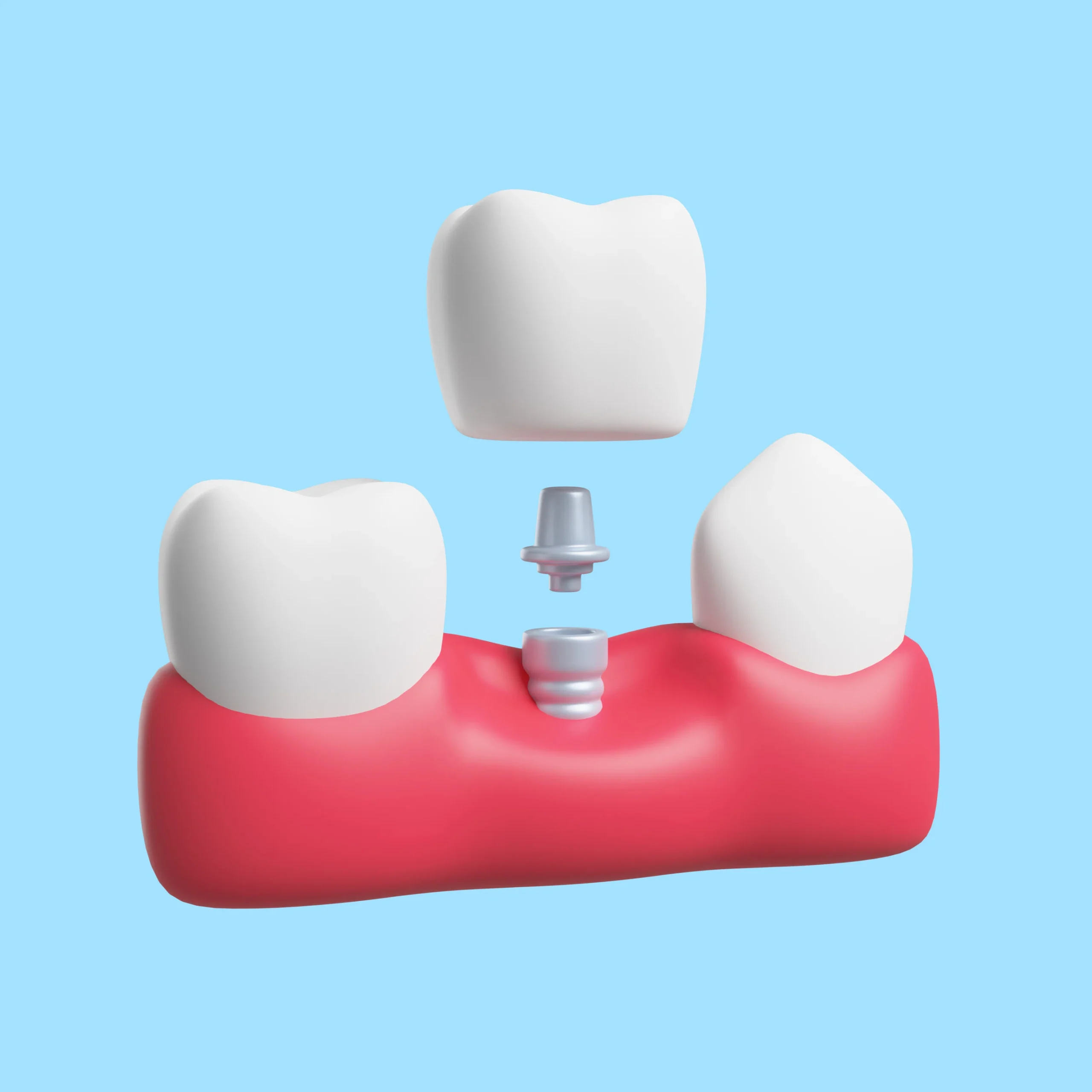 Vita Dentures