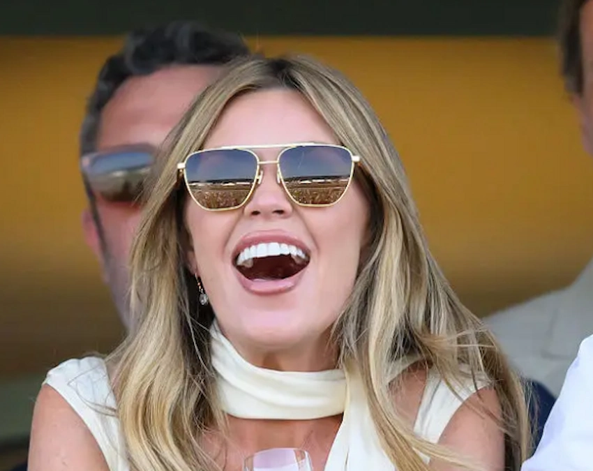 denti di abbey clancy 2025