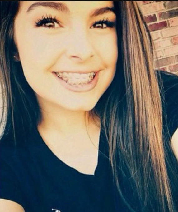 addison rae teeth in 2015