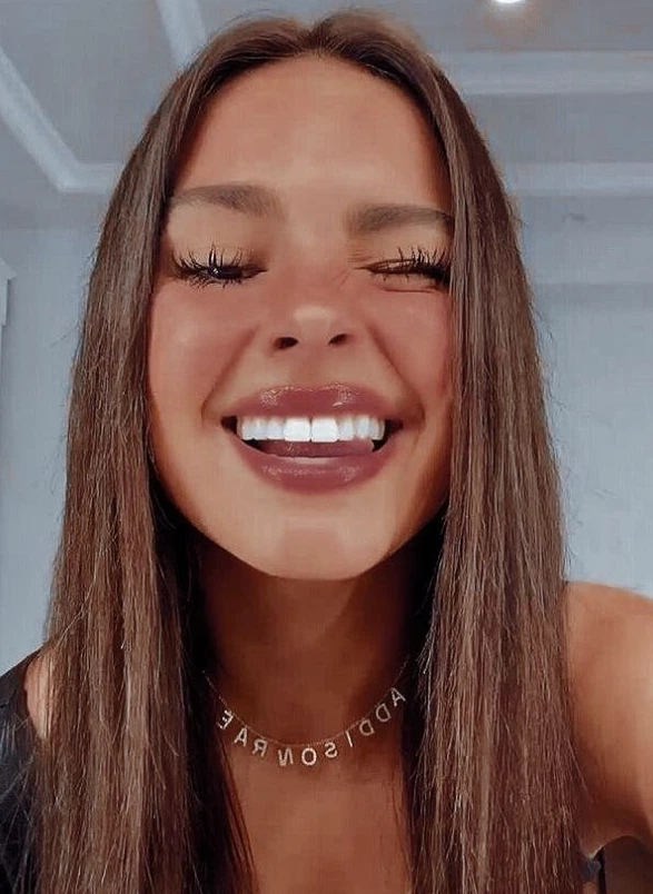 addison rae teeth in 2025