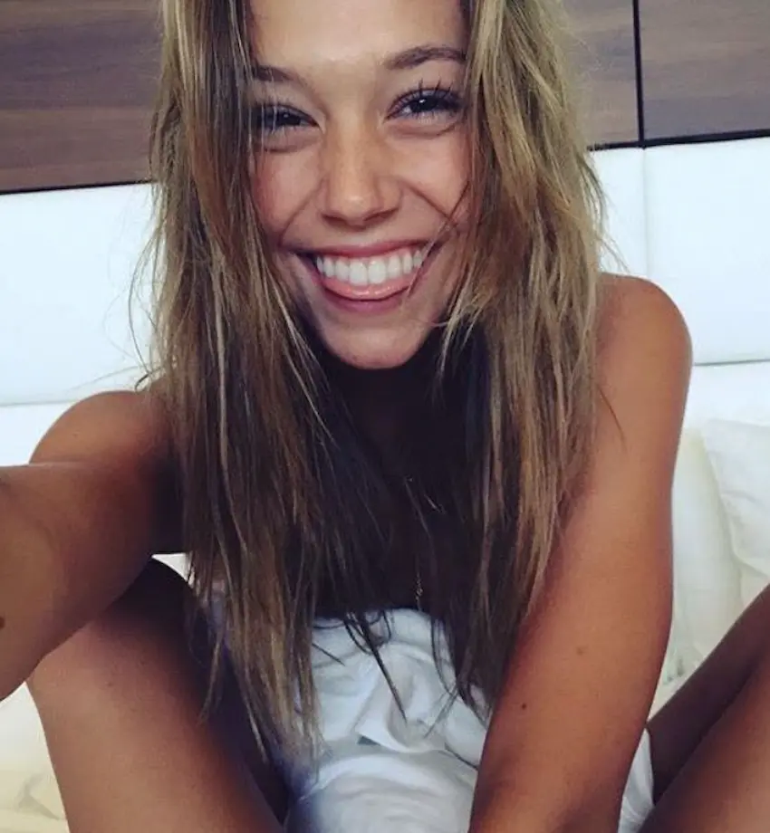 alexis ren teeth 2005s