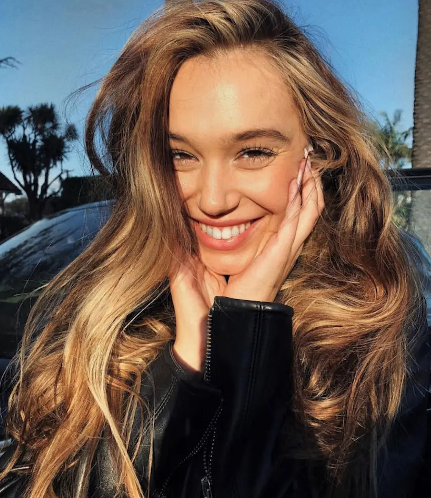 alexis ren teeth 2010s