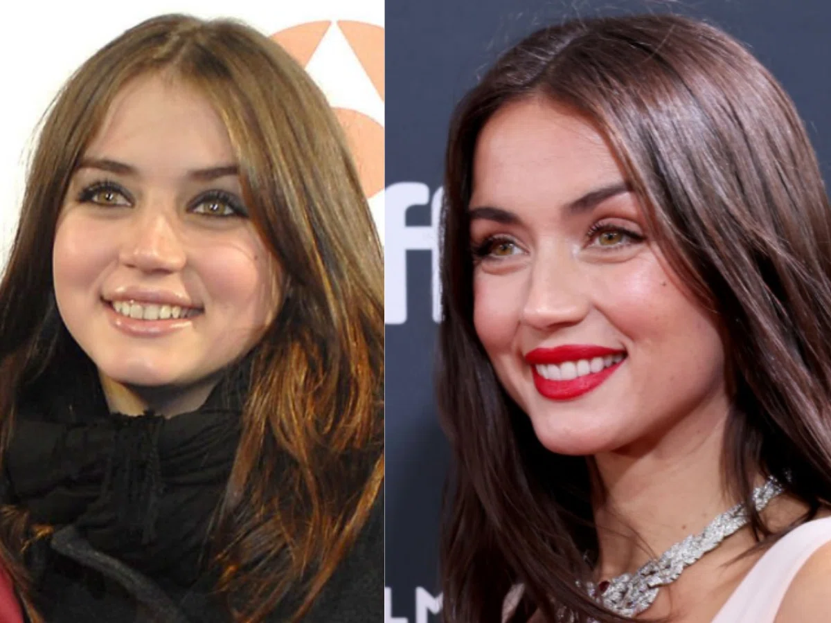 ana de armas teeth before after
