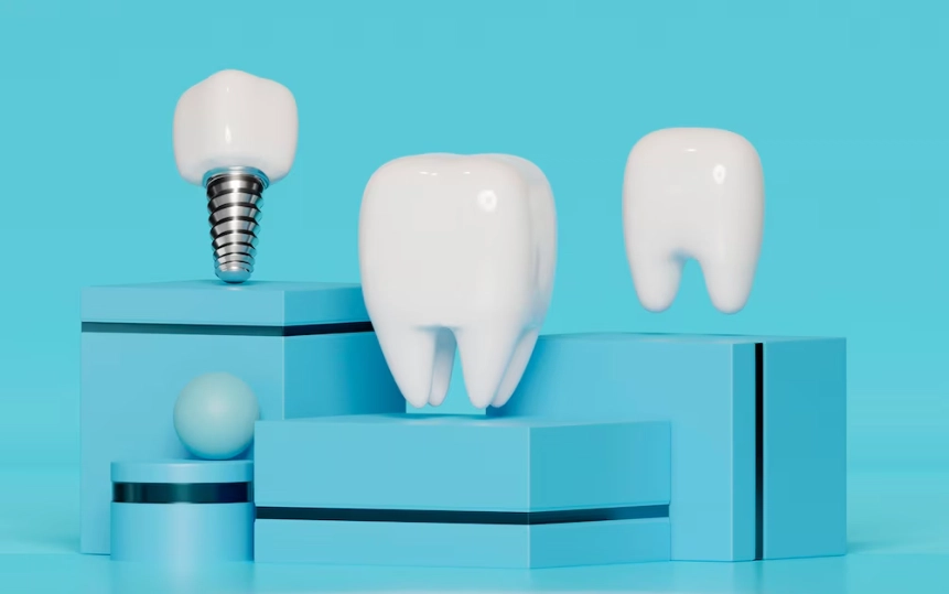 are bego dental implants dental products strong safe