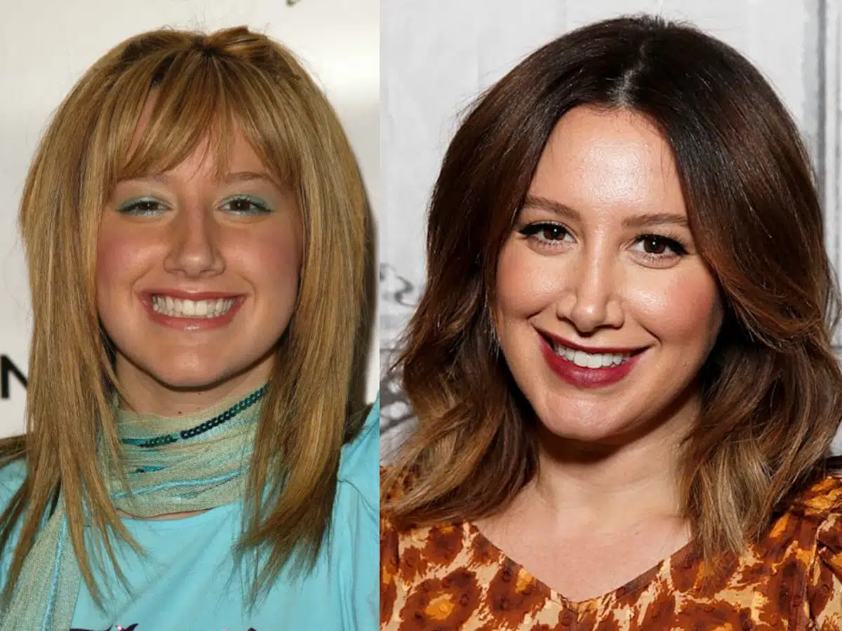 ashley tisdale teeth before after