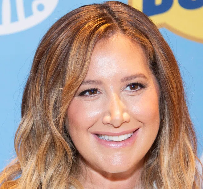 ashley tisdale teeth in 2025