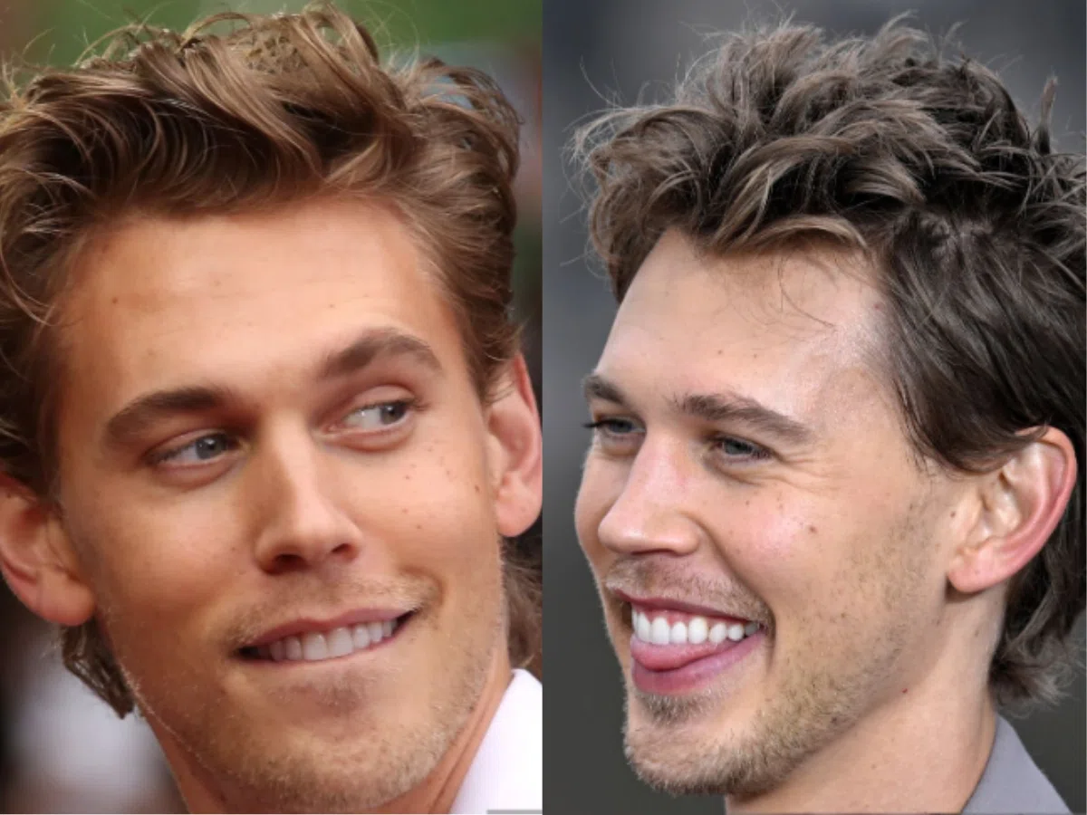 austin butler teeth