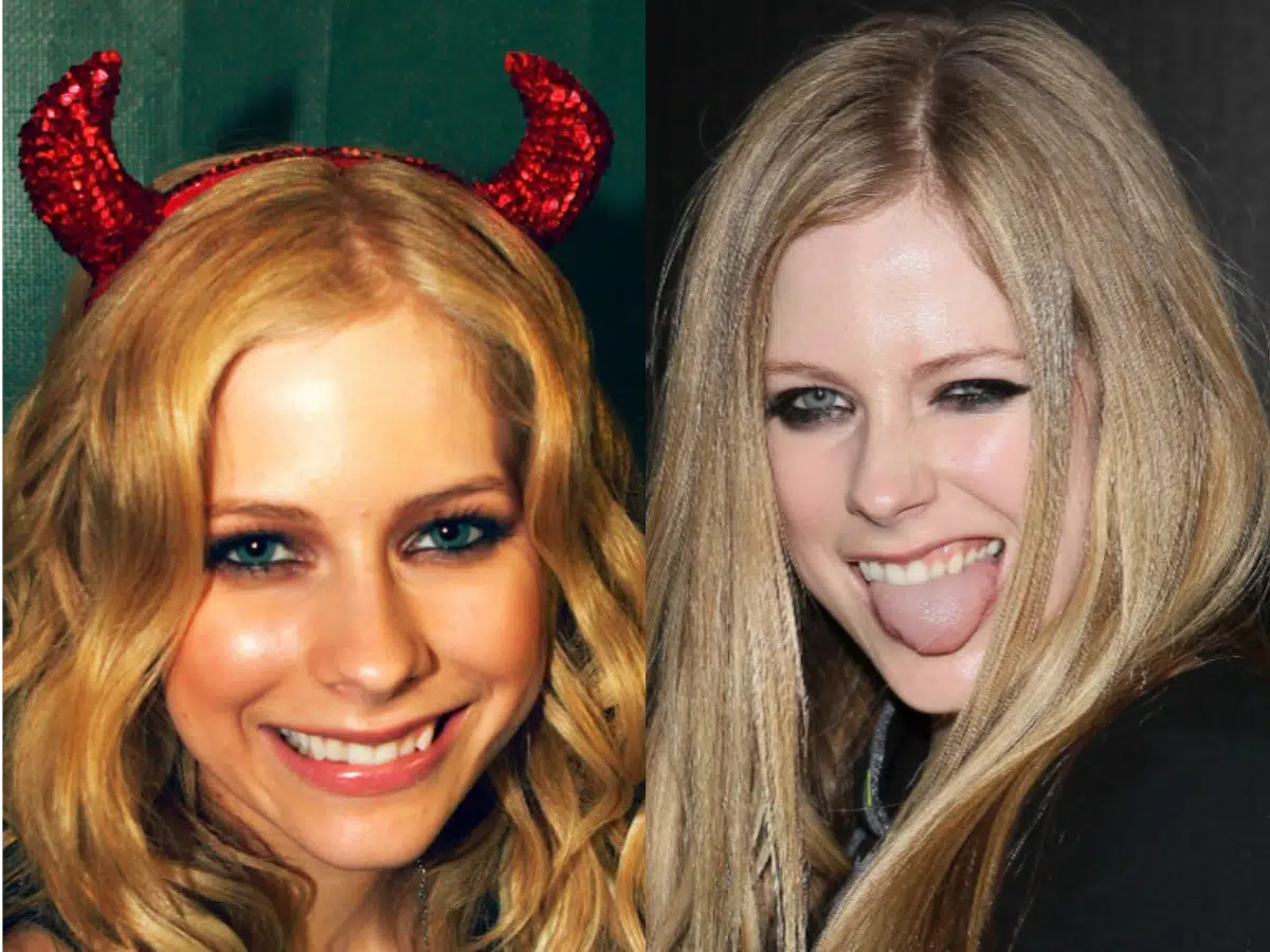 avril lavigne teeth before after