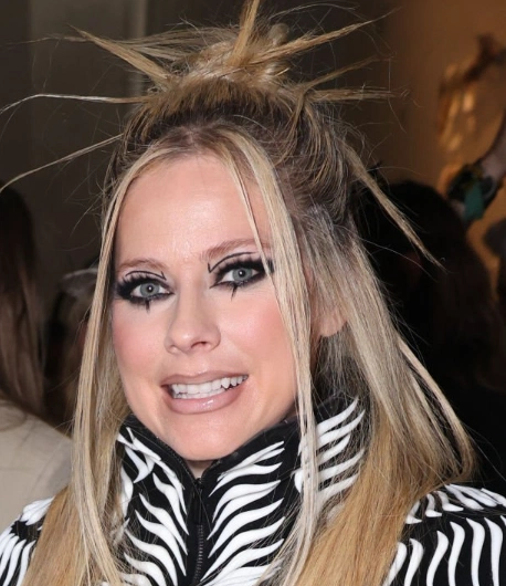 dientes de avril lavigne en 2025