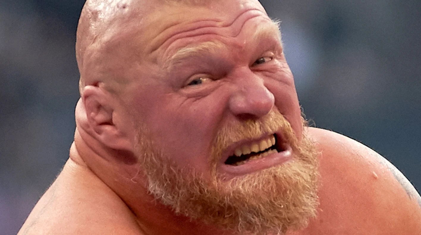 brock lesnar teeth hollywood smile before after