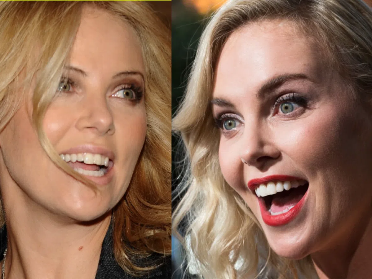 charlize theron teeth before after