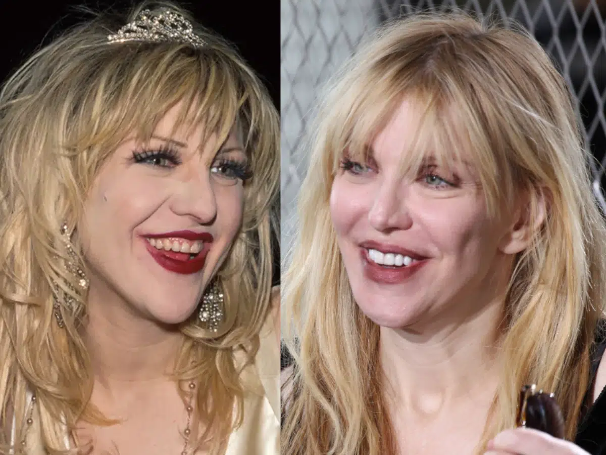Courtney Love's Strahlende Lächeln-Transformation