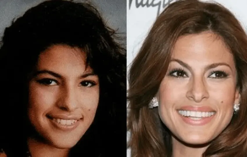 eva mendes teeth transformation