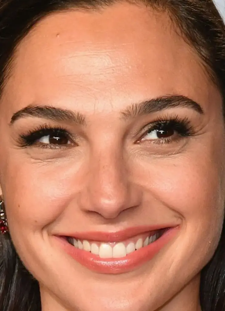 gal gadot teeth 2020s