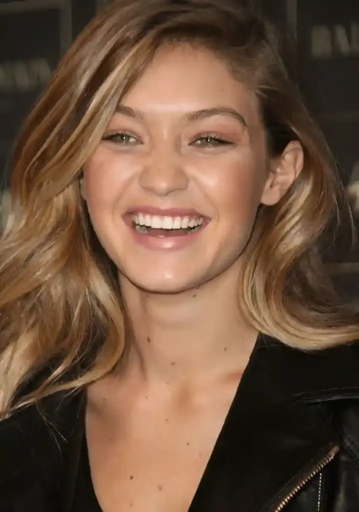 gigi hadid teeth 2015s