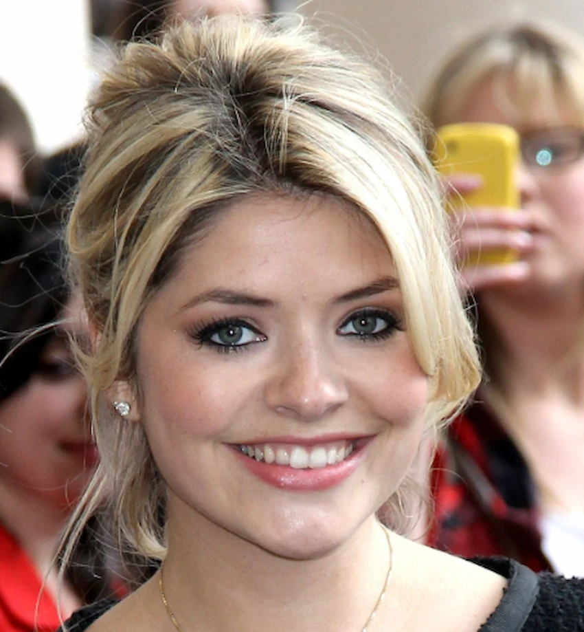 dents de holly willoughby 2010