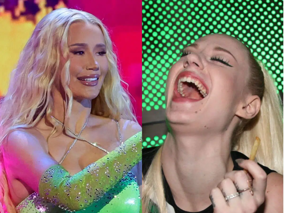 Iggy Azalea’s New Teeth Now: Before and After Veneers