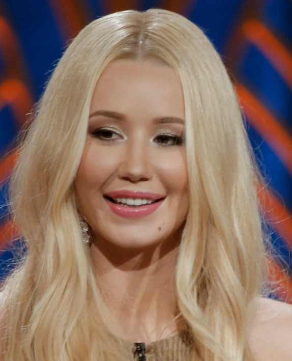 dientes de iggy azalea en 2017