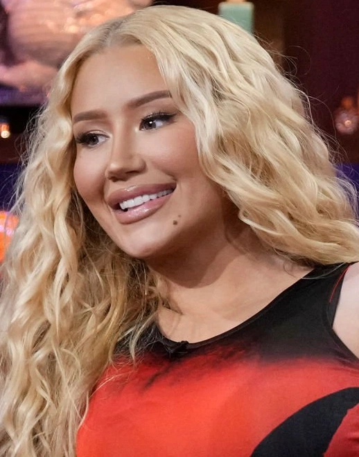 dientes de iggy azalea en 2023