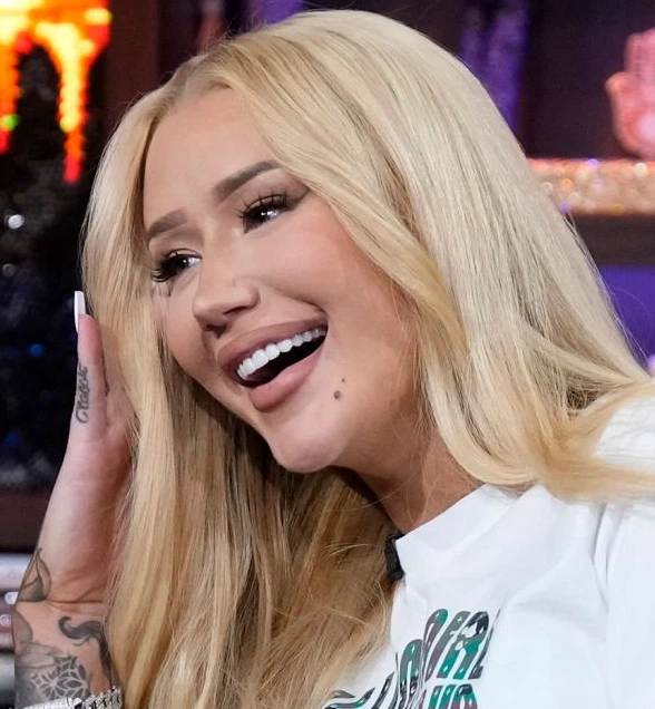 dientes de iggy azalea en 2025