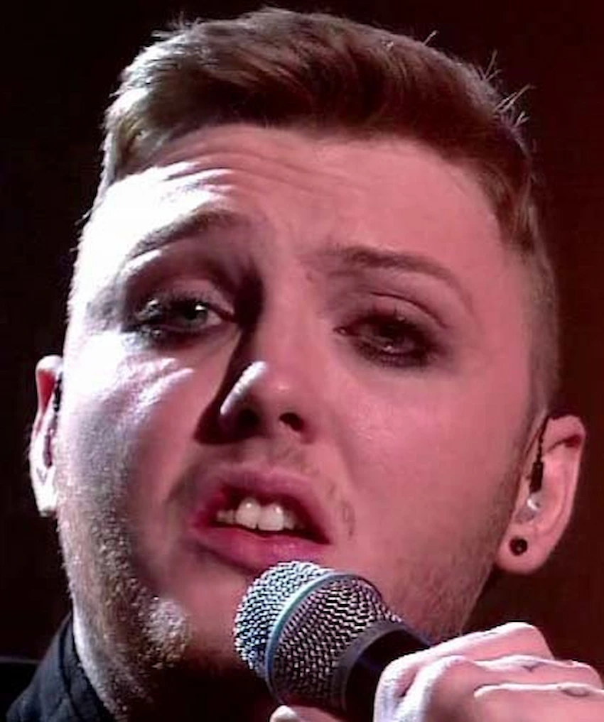 dents de james arthur 2010