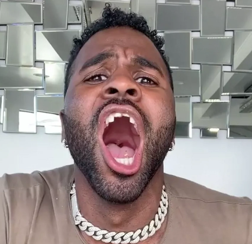 jason derulo teeth 2020