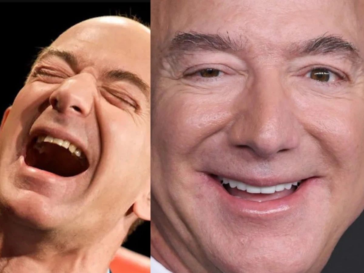 jeff bezos teeth before after