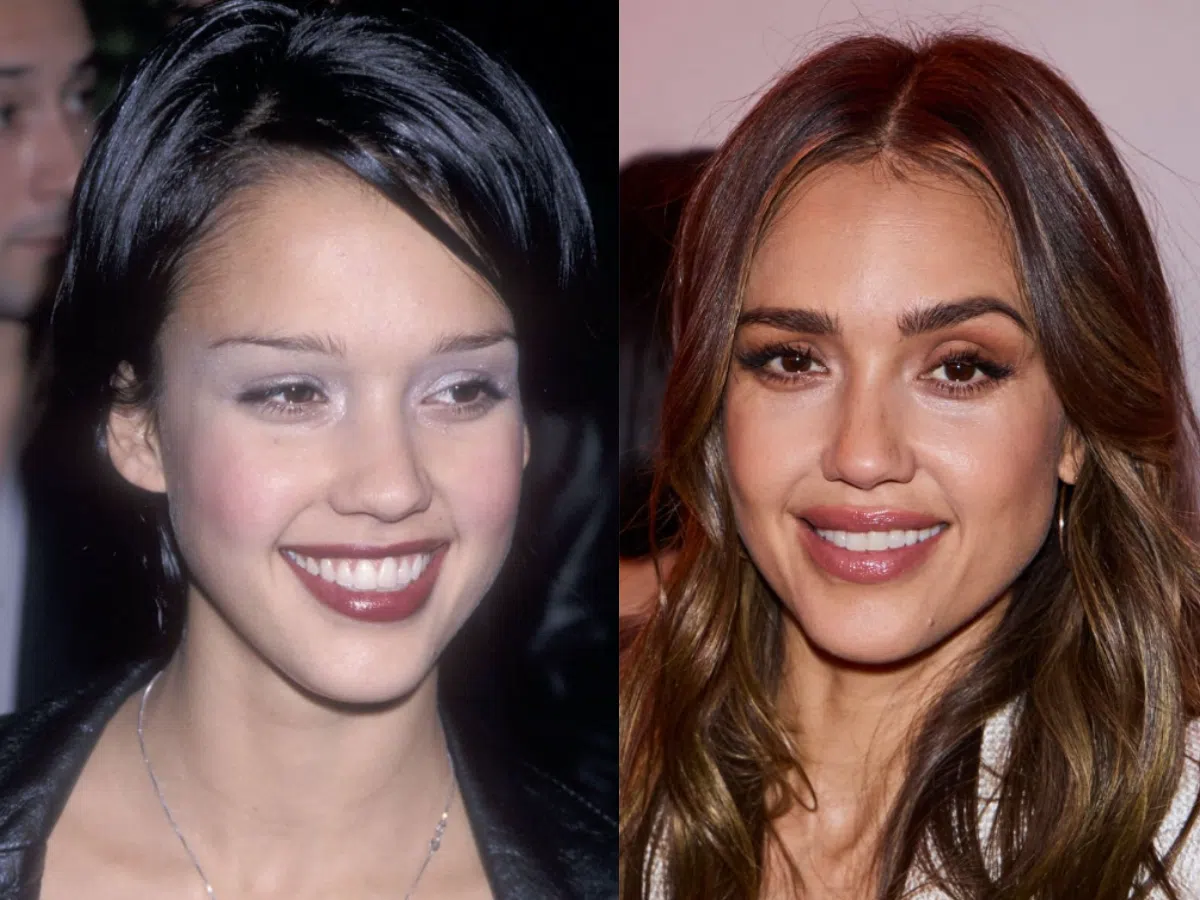 Jessica Alba’s Perfect Teeth: No Cavities, No Flaws